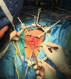 MINI-BOOKLER® ENT / THYROID BASIC SYSTEM | REF. NO. 72230-B