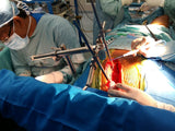 IMA Retractor System