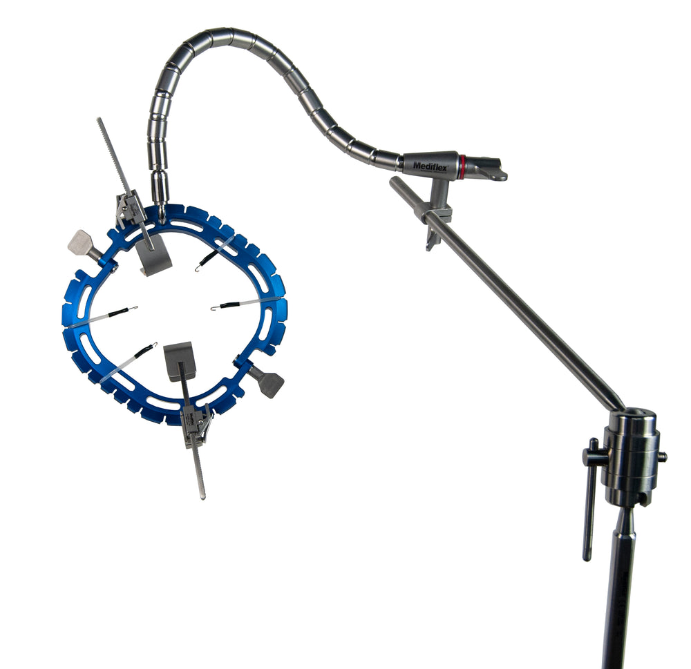 Retractor Frame DynaTrac® Retractor Frames – Mediflex Surgical Products