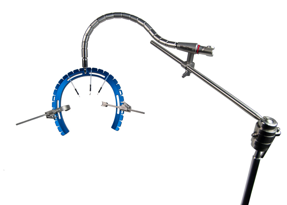 Danforth Retractor DynaTrac® Retractor Frames – Mediflex Surgical Products